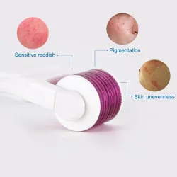 LED electric micro needles - derma roller - titanium - skin careSkóra