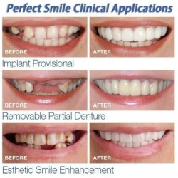 Silicone teeth cover - denture 2 piecesMouth